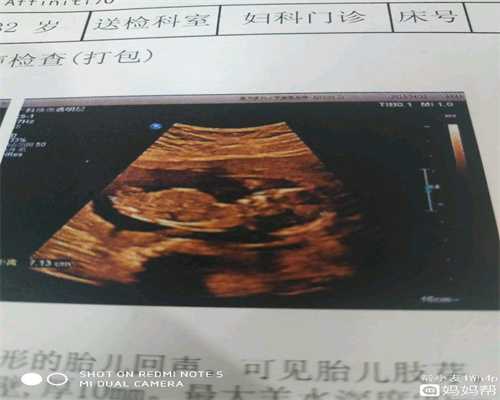 广州试管代孕价格：助孕检查都正常，就是不能