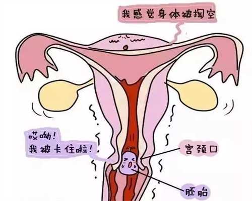 赣州代孕_赣州供卵代孕,卵巢不排卵导致不孕怎么