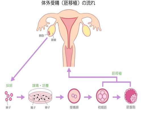 试管婴儿代孕网,输卵管通水是什么意思,马路上代