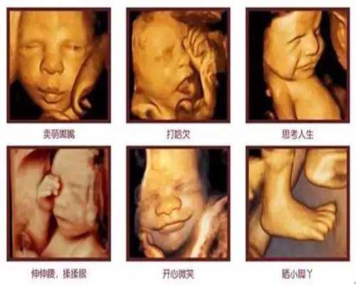 代孕网～【生孩子，更健康】～孕早期是胎儿畸